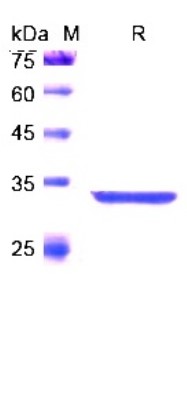 SDS PAGE (ASS1-0626H).jpg